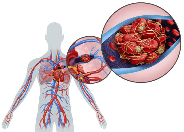 Tachypnea: Why does Breathing Happen Faster Than Usual?