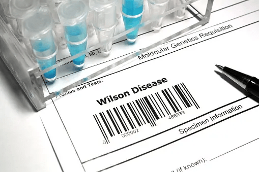 Wilson's Disease: Examining Wilson's Disease's Genetics and Effects