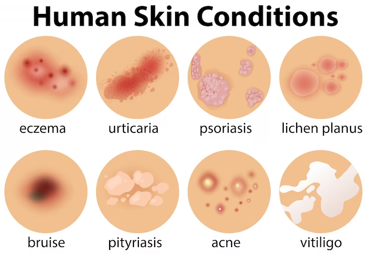 skin problem in hindi